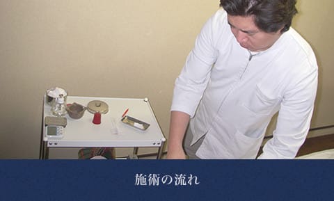 施術の流れ